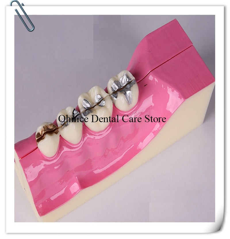 dental lab tooth model molar cross section study teeth model